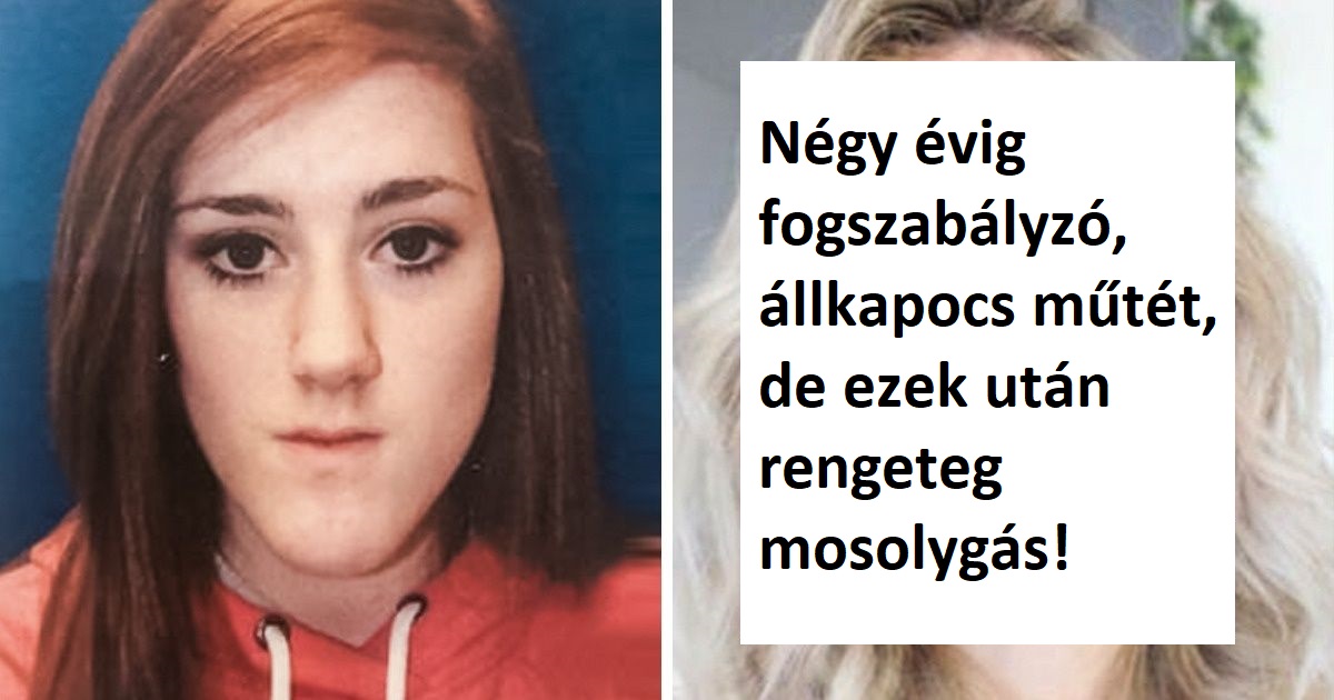 20 ember aki megtanulta hogy a szépségért igenis szenvedni kell